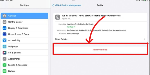 ipados 17 Remove Profile